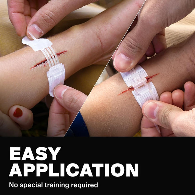 Zip Stitch Wound Closure Kit – No-Stitch Laceration Repair Strips